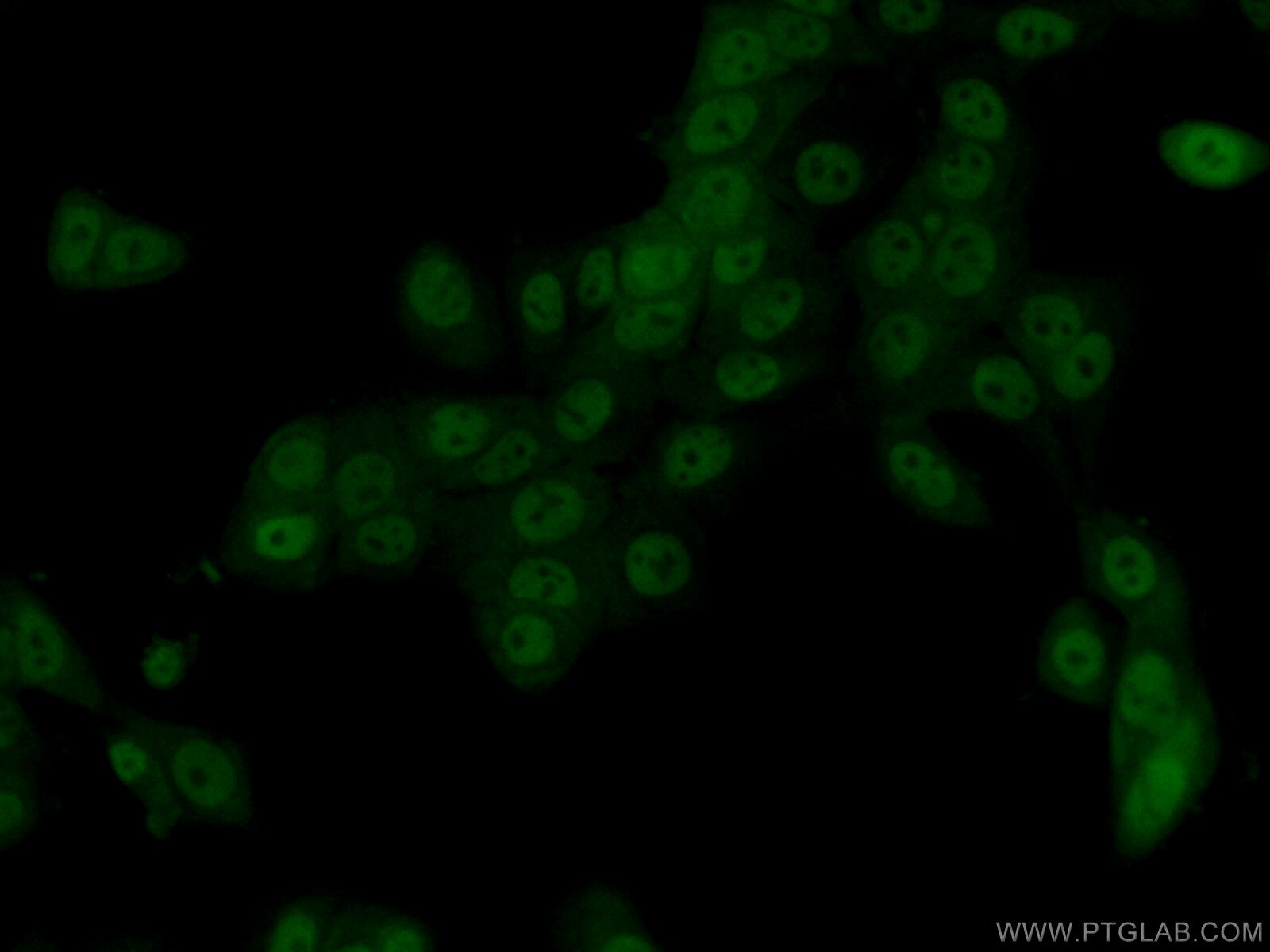 IF Staining of MCF-7 using 13482-1-AP