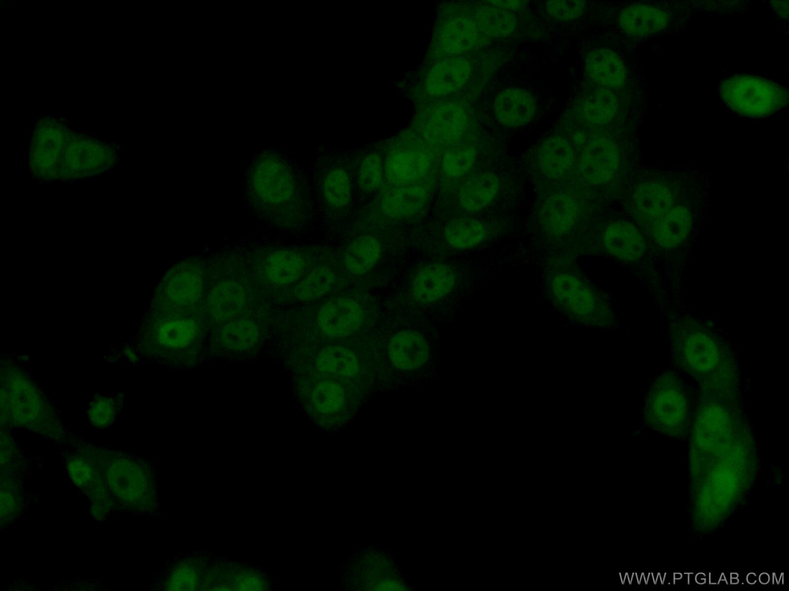 Immunofluorescence (IF) / fluorescent staining of MCF-7 cells using PPP2CA Polyclonal antibody (13482-1-AP)