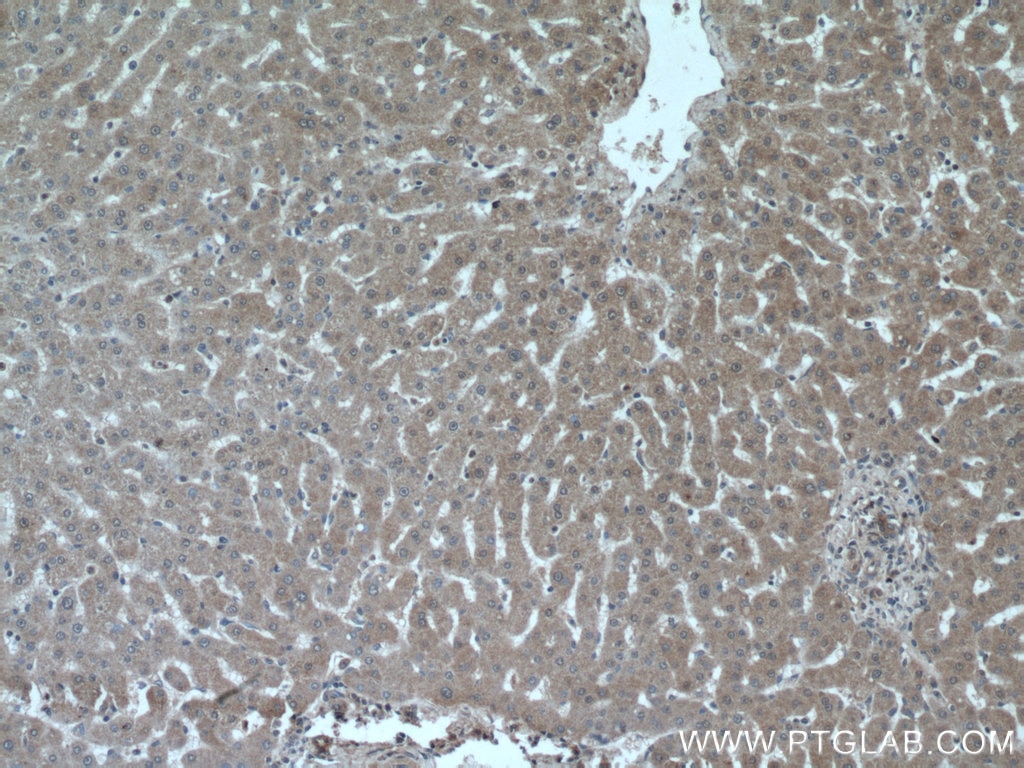 Immunohistochemistry (IHC) staining of human liver tissue using PPP2CA Polyclonal antibody (13482-1-AP)