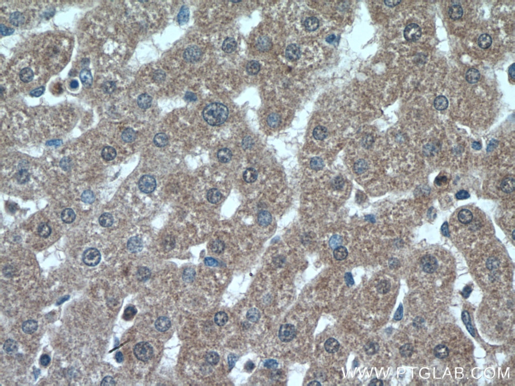 Immunohistochemistry (IHC) staining of human liver tissue using PPP2CA Polyclonal antibody (13482-1-AP)