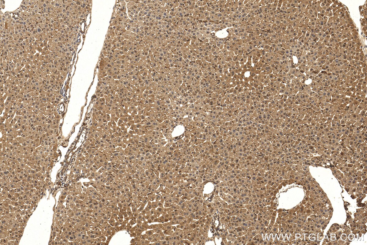 Immunohistochemistry (IHC) staining of mouse liver tissue using PPP2CA Polyclonal antibody (13482-1-AP)