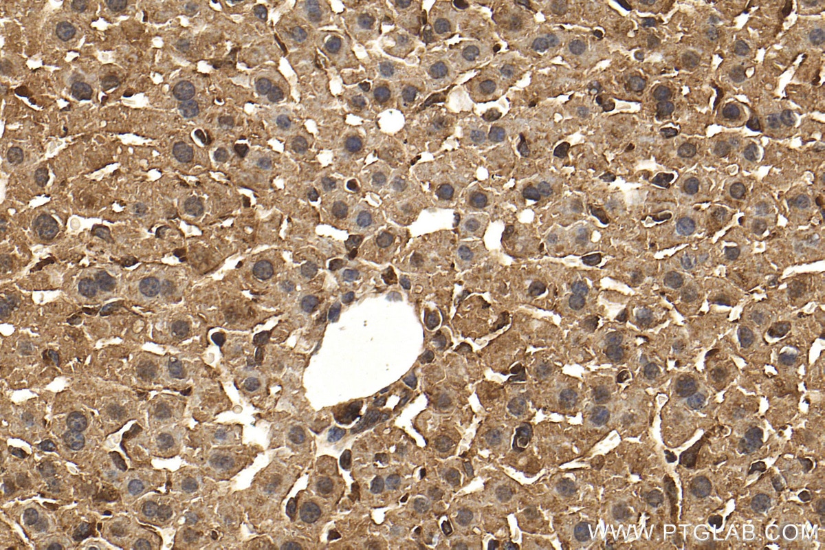 Immunohistochemistry (IHC) staining of mouse liver tissue using PPP2CA Polyclonal antibody (13482-1-AP)