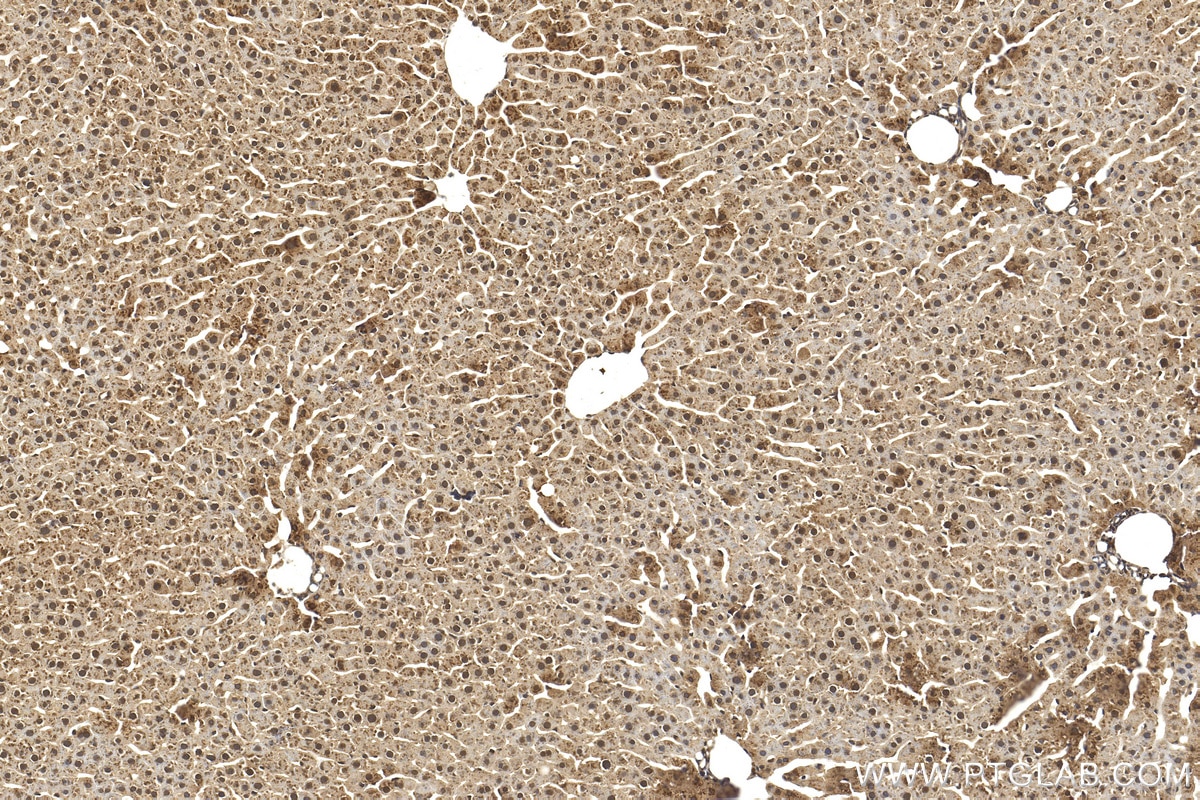 Immunohistochemistry (IHC) staining of rat liver tissue using PPP2CA Polyclonal antibody (13482-1-AP)