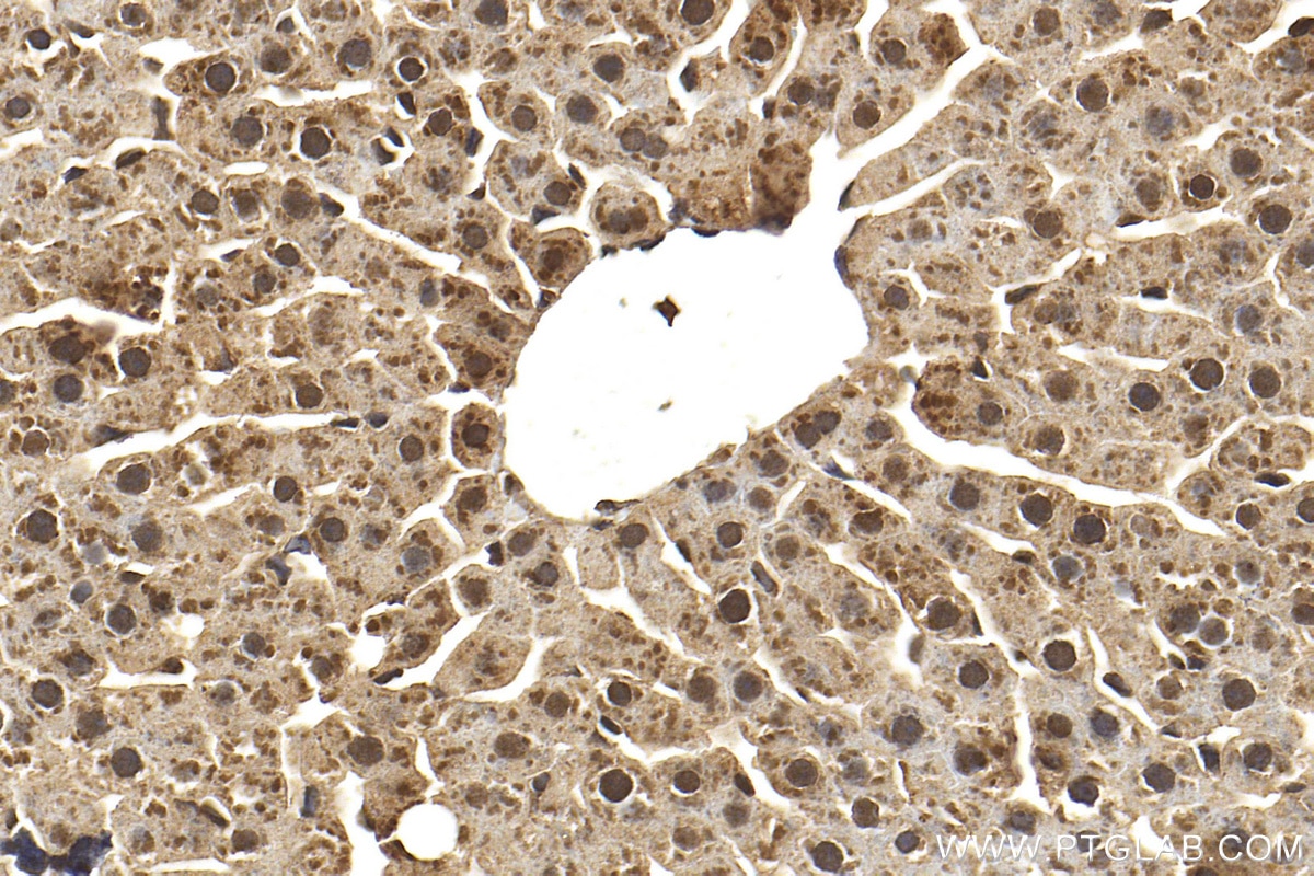 Immunohistochemistry (IHC) staining of rat liver tissue using PPP2CA Polyclonal antibody (13482-1-AP)