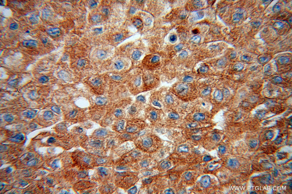 PPP2CA Polyclonal antibody