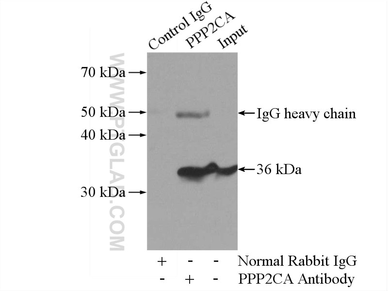 Immunoprecipitation (IP) experiment of Jurkat cells using PPP2CA Polyclonal antibody (13482-1-AP)