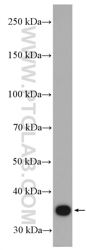 Western Blot (WB) analysis of Jurkat cells using PPP2CA Polyclonal antibody (13482-1-AP)