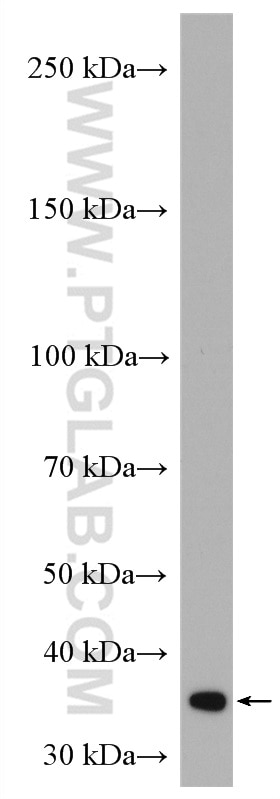 Western Blot (WB) analysis of MCF-7 cells using PPP2CA Polyclonal antibody (13482-1-AP)