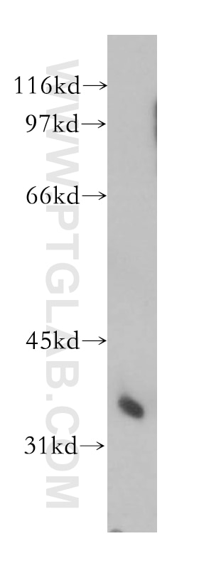 Western Blot (WB) analysis of human liver tissue using PPP2CA Polyclonal antibody (13482-1-AP)