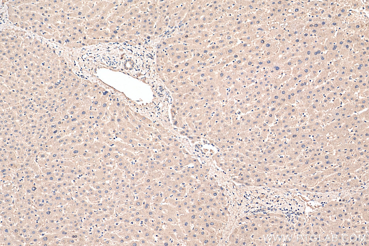 Immunohistochemistry (IHC) staining of human liver tissue using PPP2CA Monoclonal antibody (67809-1-Ig)