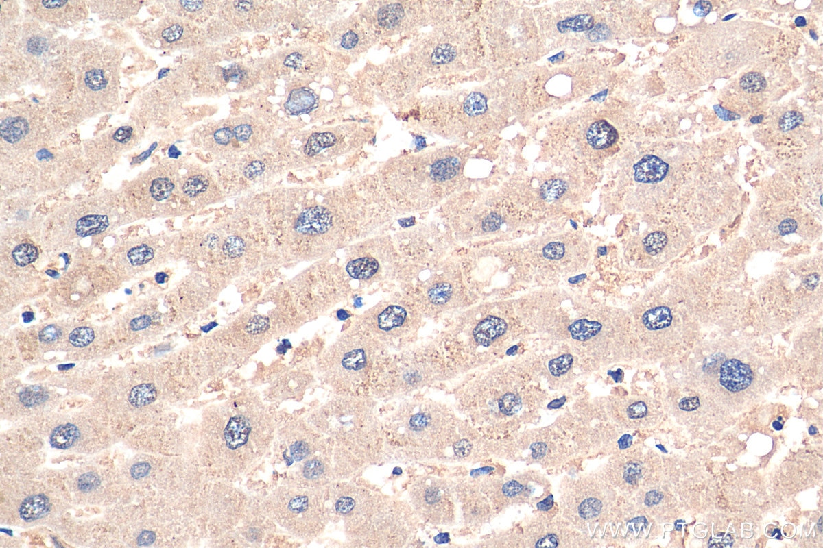 Immunohistochemistry (IHC) staining of human liver tissue using PPP2CA Monoclonal antibody (67809-1-Ig)