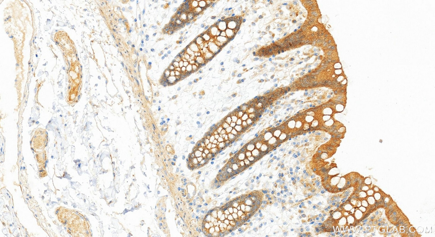 Immunohistochemistry (IHC) staining of human colon tissue using PPP2CA Recombinant monoclonal antibody (84155-2-RR)