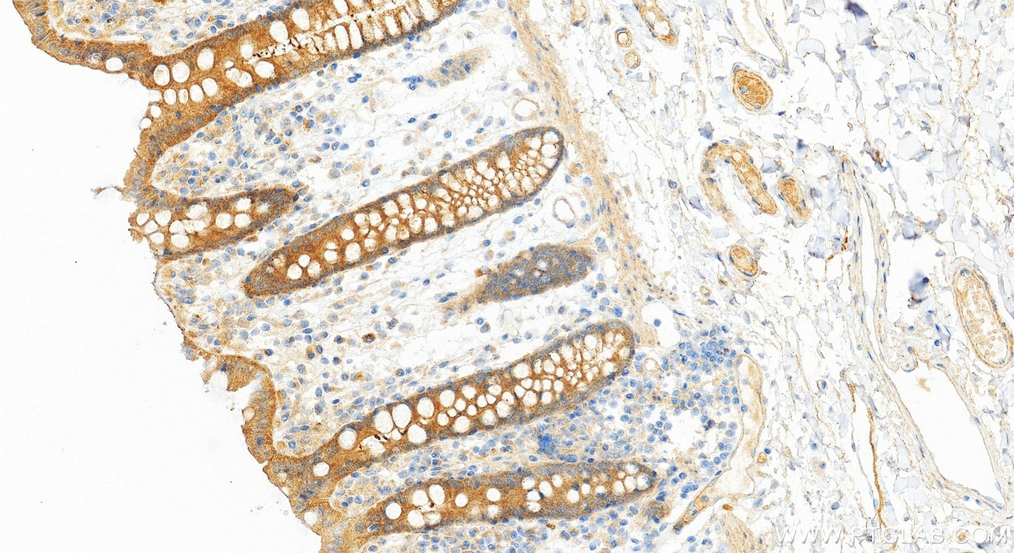 Immunohistochemistry (IHC) staining of human colon tissue using PPP2CA Recombinant monoclonal antibody (84155-2-RR)