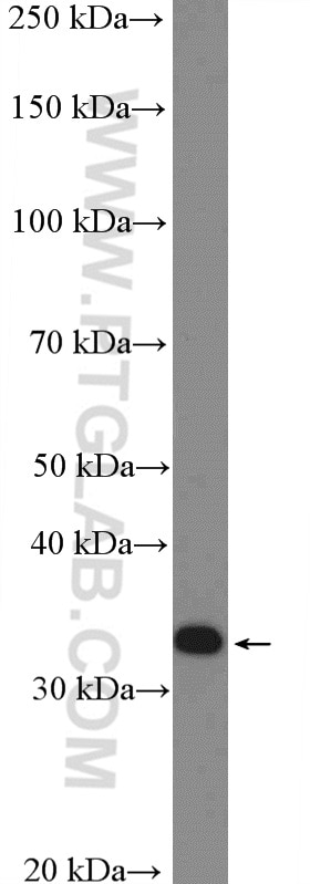Western Blot (WB) analysis of U2OS cells using PPP2CB Polyclonal antibody (12554-2-AP)