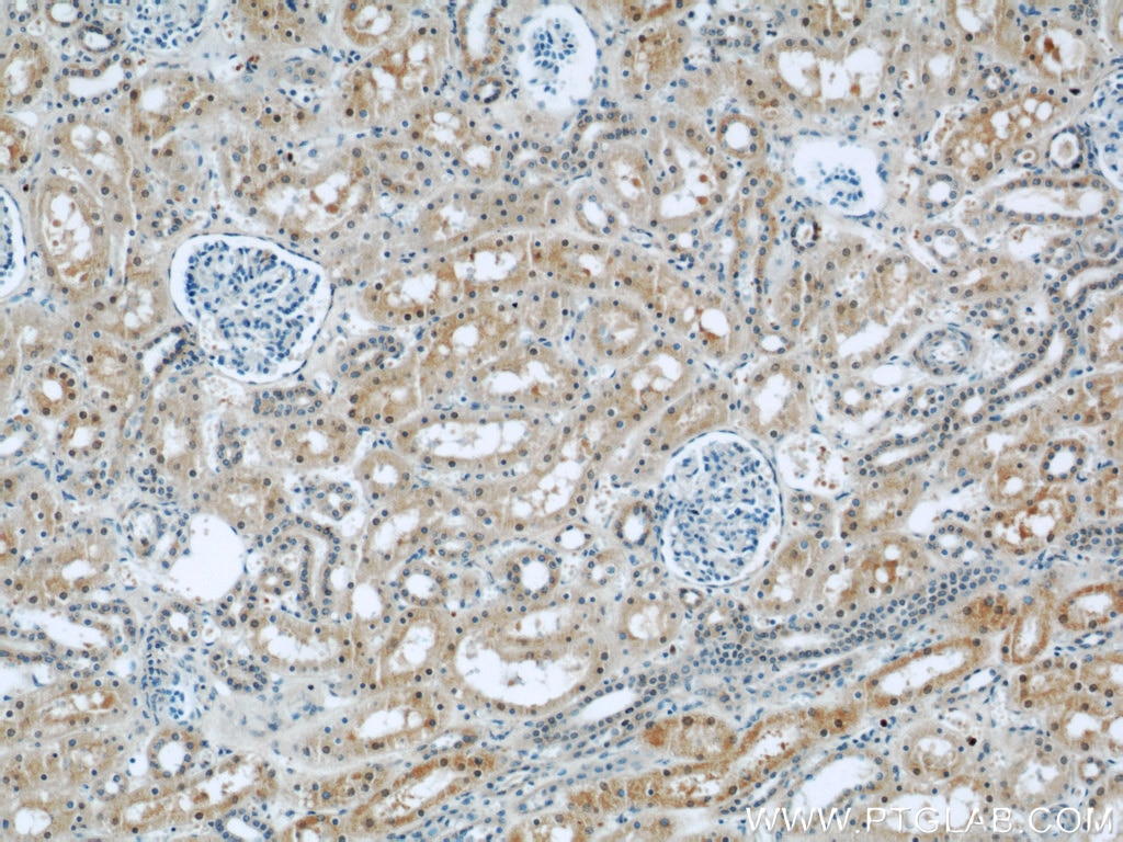 Immunohistochemistry (IHC) staining of human kidney tissue using PPP2R1A Polyclonal antibody (15882-1-AP)