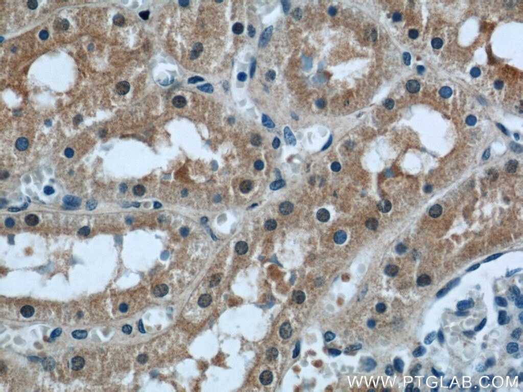 Immunohistochemistry (IHC) staining of human kidney tissue using PPP2R1A Polyclonal antibody (15882-1-AP)