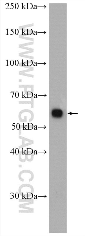 Western Blot (WB) analysis of SMMC-7721 cells using PPP2R1A Polyclonal antibody (15882-1-AP)