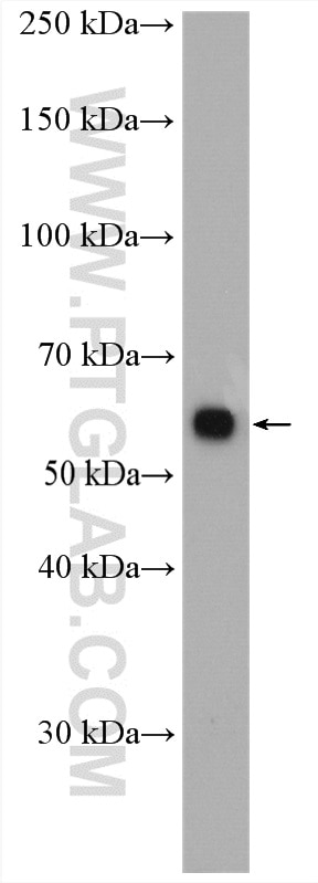 WB analysis of SMMC-7721 using 15882-1-AP