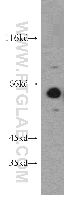 Western Blot (WB) analysis of HepG2 cells using PPP2R1A Polyclonal antibody (15882-1-AP)