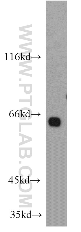 Western Blot (WB) analysis of mouse kidney tissue using PPP2R1A Polyclonal antibody (15882-1-AP)