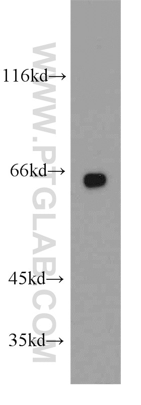 Western Blot (WB) analysis of A431 cells using PPP2R1A Polyclonal antibody (15882-1-AP)