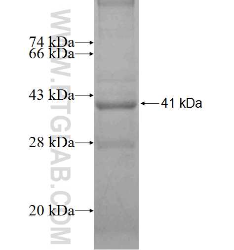 PPP2R1A fusion protein Ag8549 SDS-PAGE