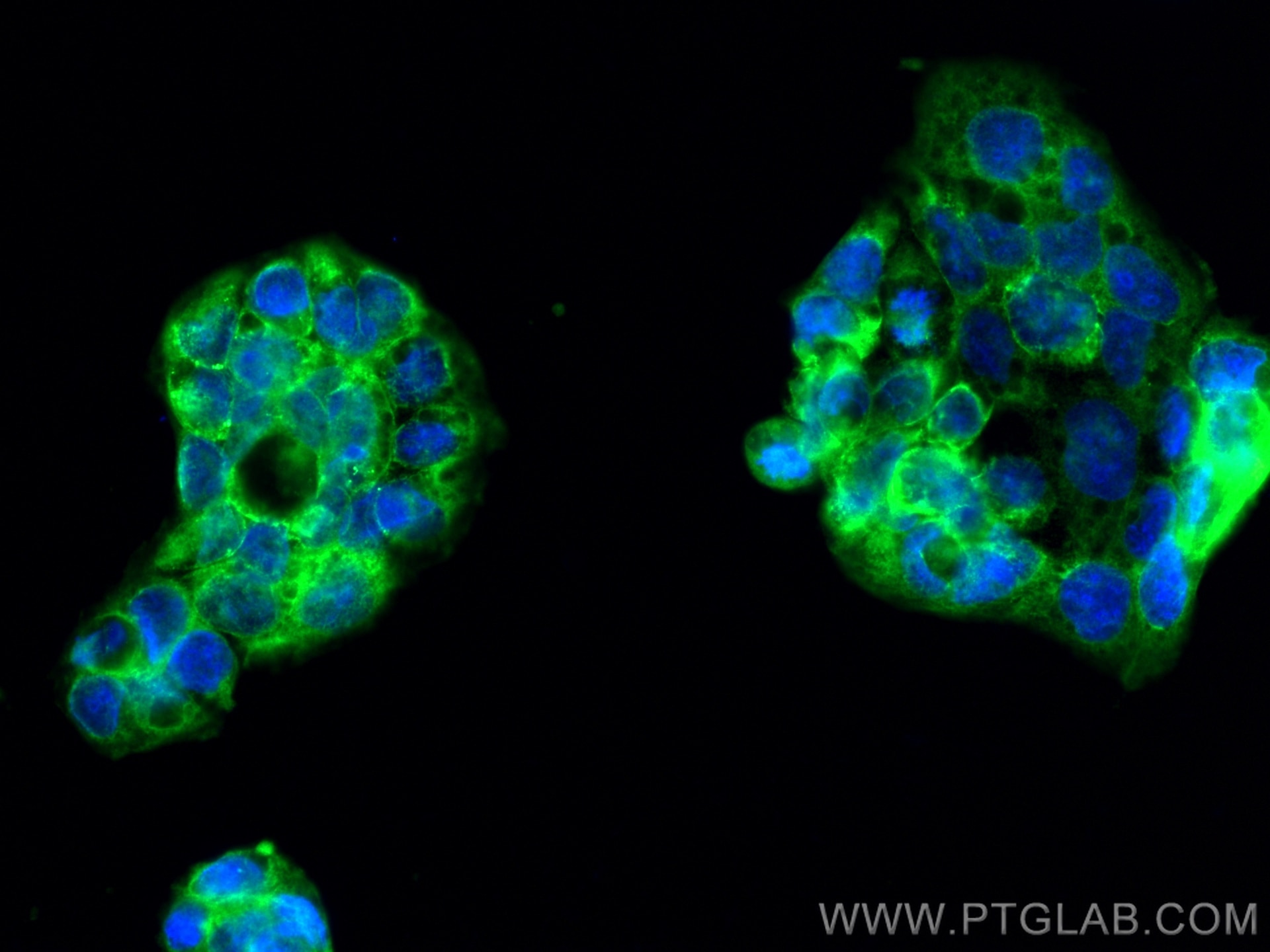 Immunofluorescence (IF) / fluorescent staining of Caco-2 cells using PPP2R1B Polyclonal antibody (12621-1-AP)