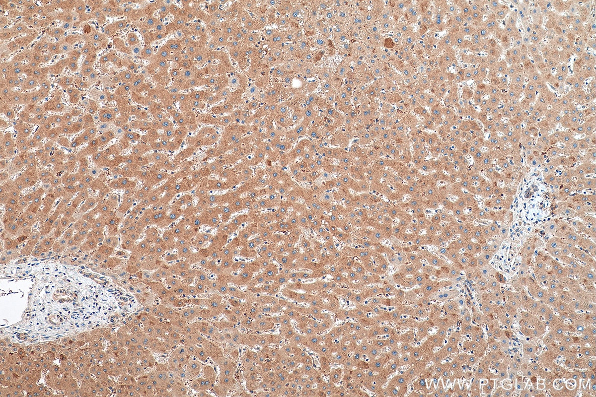 Immunohistochemistry (IHC) staining of human liver tissue using PPP2R1B Polyclonal antibody (12621-1-AP)