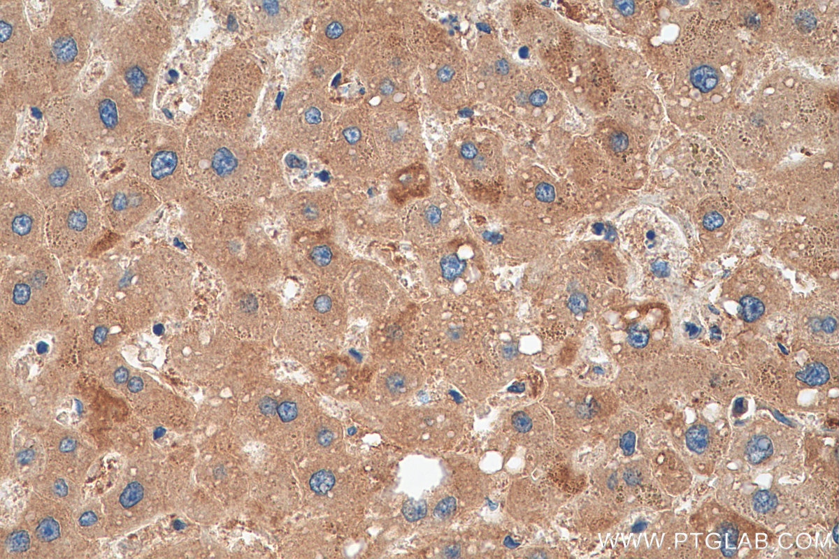 Immunohistochemistry (IHC) staining of human liver tissue using PPP2R1B Polyclonal antibody (12621-1-AP)