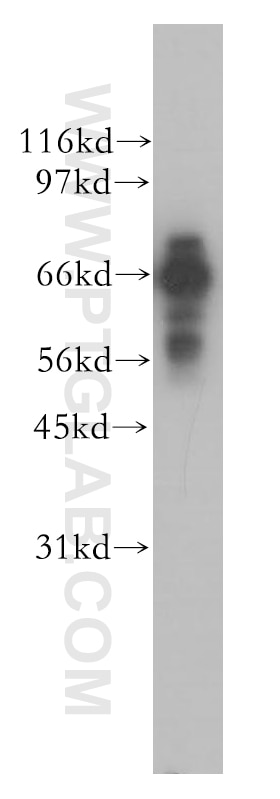 Western Blot (WB) analysis of human kidney tissue using PPP2R1B Polyclonal antibody (12621-1-AP)