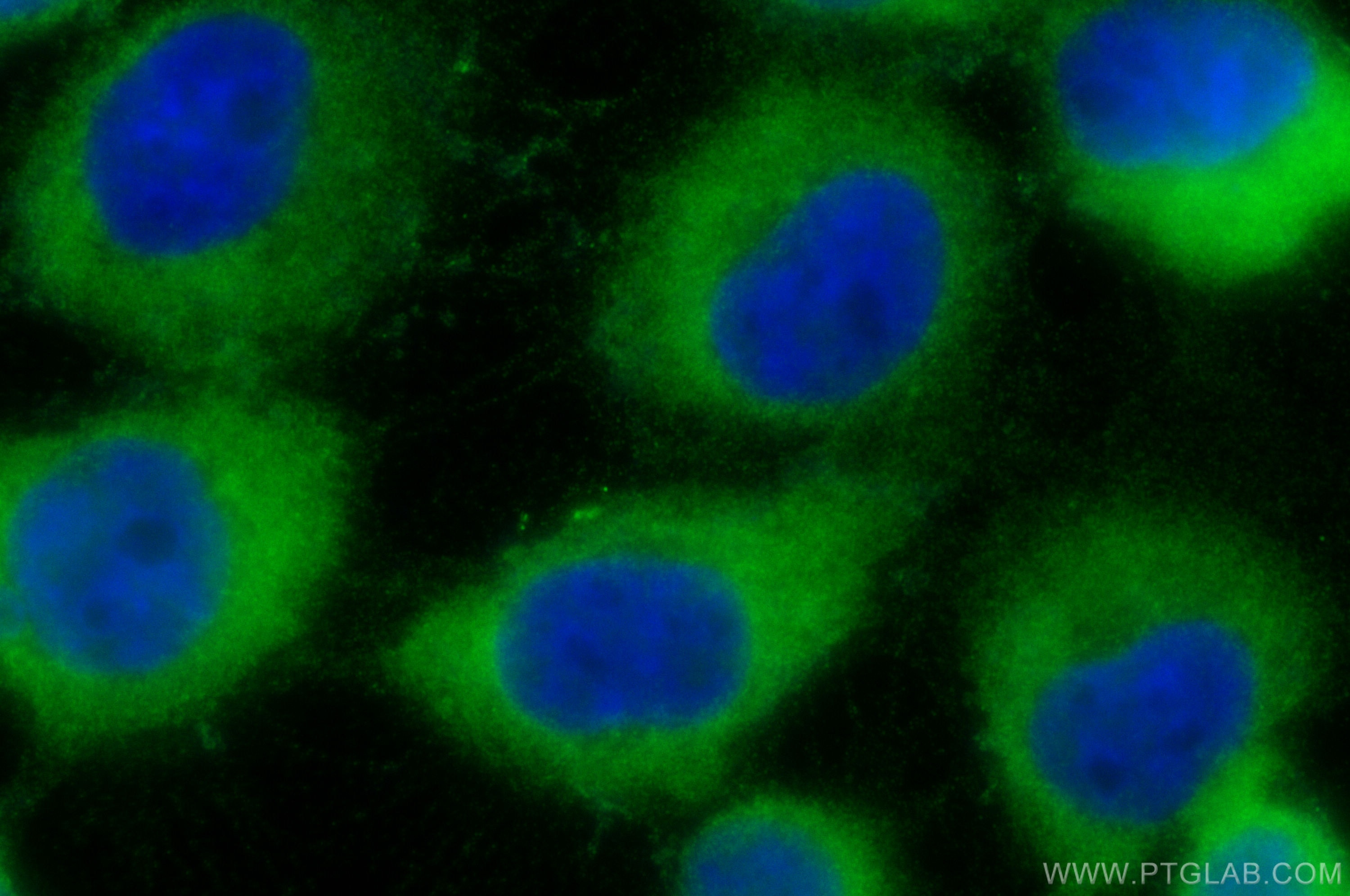 Immunofluorescence (IF) / fluorescent staining of A431 cells using PPP2R2A Polyclonal antibody (16569-1-AP)