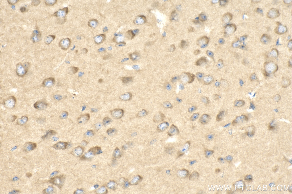 Immunohistochemistry (IHC) staining of mouse brain tissue using PPP2R2A Polyclonal antibody (16569-1-AP)