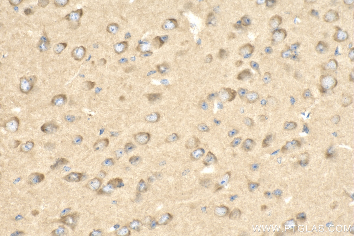 Immunohistochemistry (IHC) staining of mouse brain tissue using PPP2R2A Polyclonal antibody (16569-1-AP)