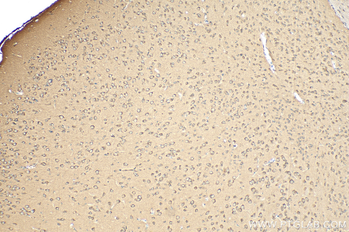 Immunohistochemistry (IHC) staining of mouse brain tissue using PPP2R2A Polyclonal antibody (16569-1-AP)