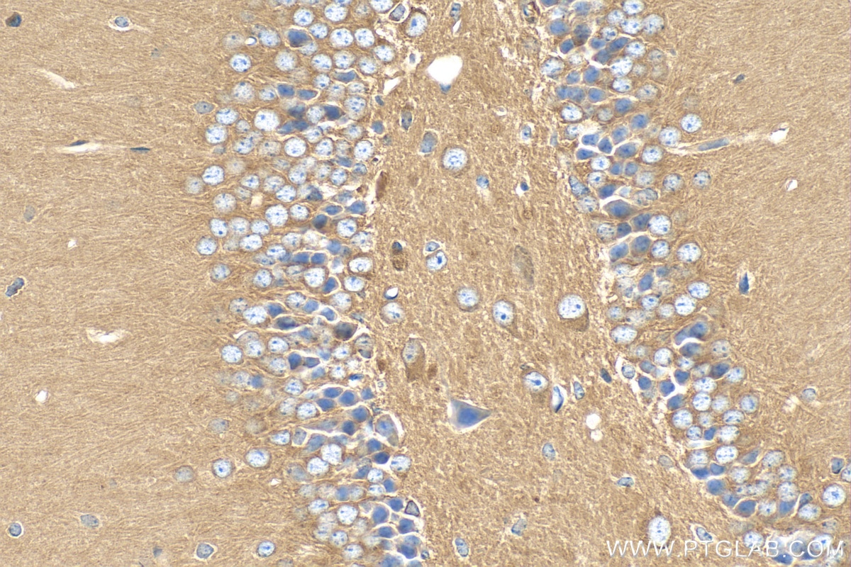 Immunohistochemistry (IHC) staining of mouse brain tissue using PPP2R2B/A/C/D Polyclonal antibody (29237-1-AP)