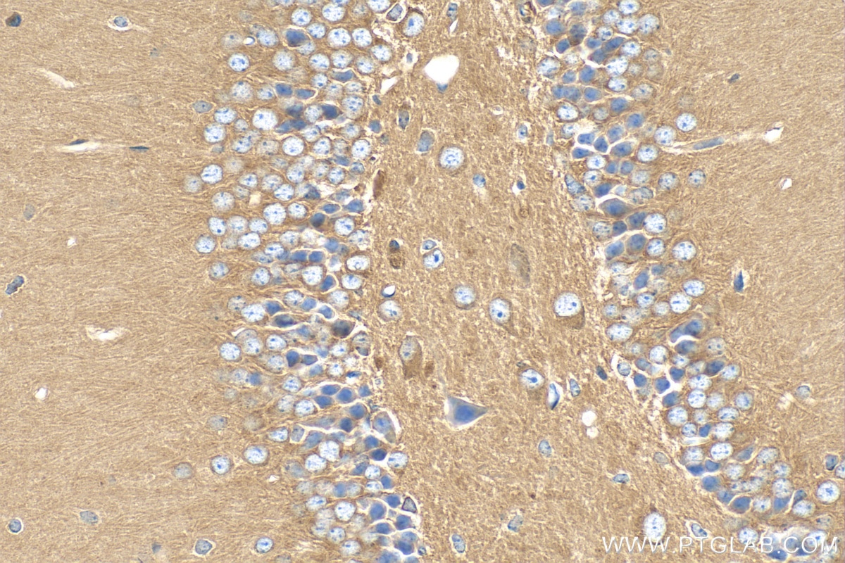 IHC staining of mouse brain using 29237-1-AP