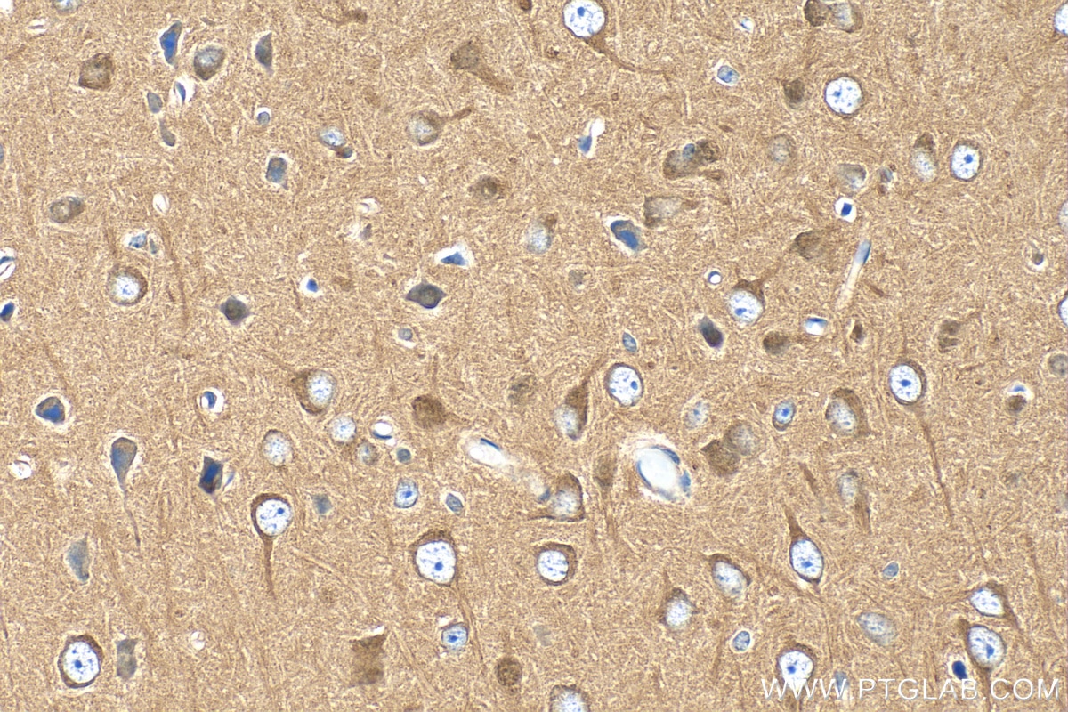 Immunohistochemistry (IHC) staining of mouse brain tissue using PPP2R2B/A/C/D Polyclonal antibody (29237-1-AP)