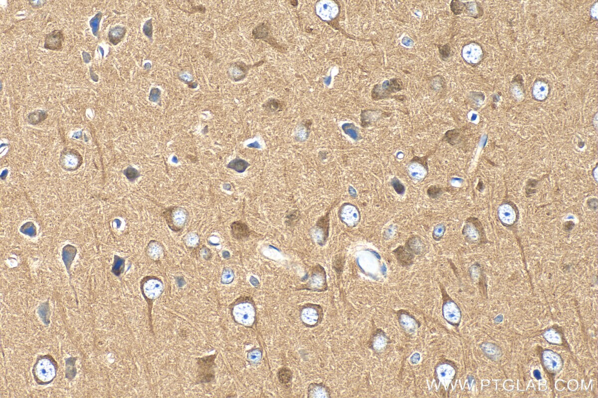 Immunohistochemistry (IHC) staining of mouse brain tissue using PPP2R2B/A/C/D Polyclonal antibody (29237-1-AP)