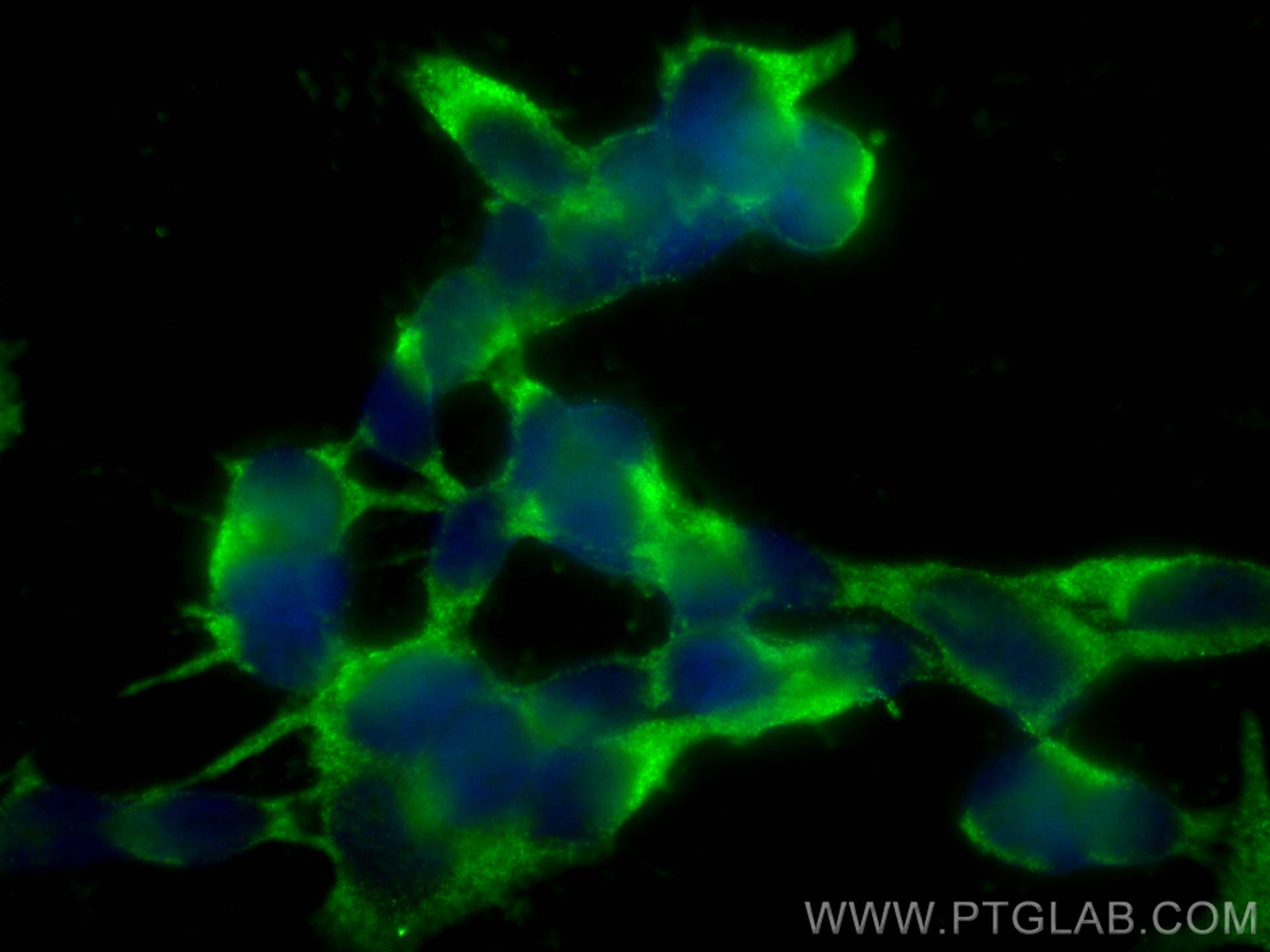 Immunofluorescence (IF) / fluorescent staining of SH-SY5Y cells using PPP2R2B/A/C/D Polyclonal antibody (13123-1-AP)