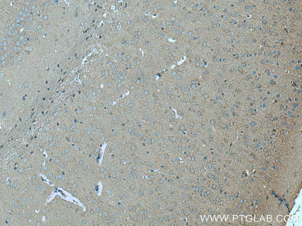 Immunohistochemistry (IHC) staining of mouse brain tissue using PPP2R2B/A/C/D Polyclonal antibody (13123-1-AP)