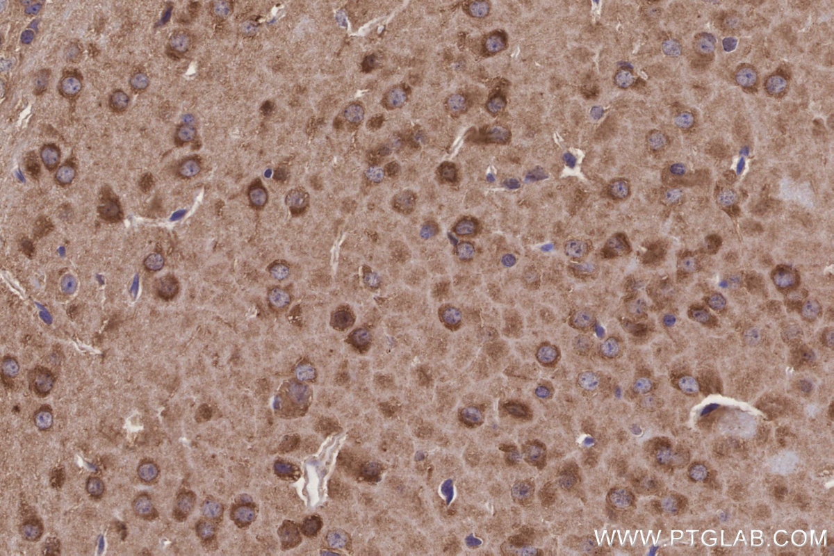 Immunohistochemistry (IHC) staining of mouse brain tissue using PPP2R2B/A/C/D Polyclonal antibody (13123-1-AP)
