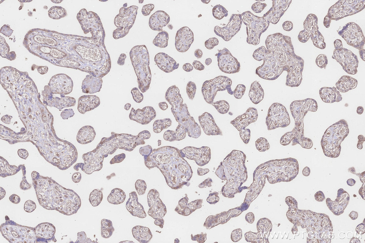 Immunohistochemistry (IHC) staining of human placenta tissue using PPP2R2B/A/C/D Polyclonal antibody (13123-1-AP)