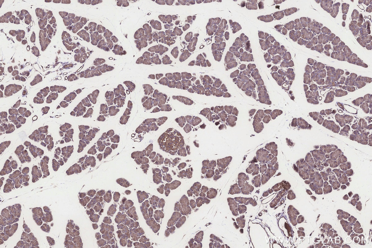 Immunohistochemistry (IHC) staining of rat pancreas tissue using PPP2R2B/A/C/D Polyclonal antibody (13123-1-AP)