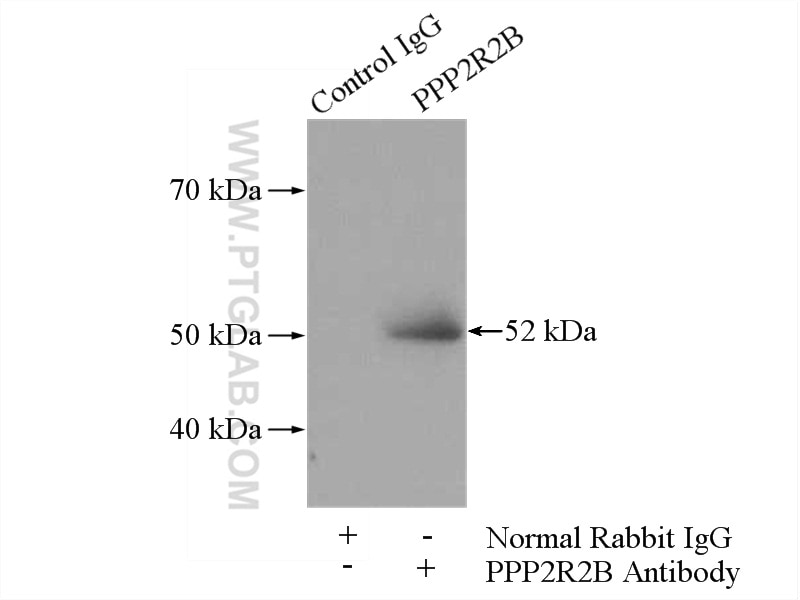 Immunoprecipitation (IP) experiment of SH-SY5Y cells using PPP2R2B/A/C/D Polyclonal antibody (13123-1-AP)