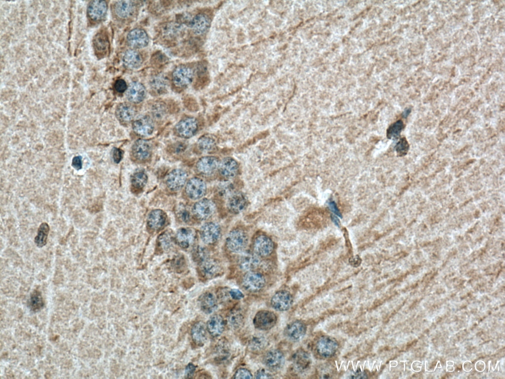 Immunohistochemistry (IHC) staining of mouse brain tissue using PPP2R2A/B/C Monoclonal antibody (67783-1-Ig)