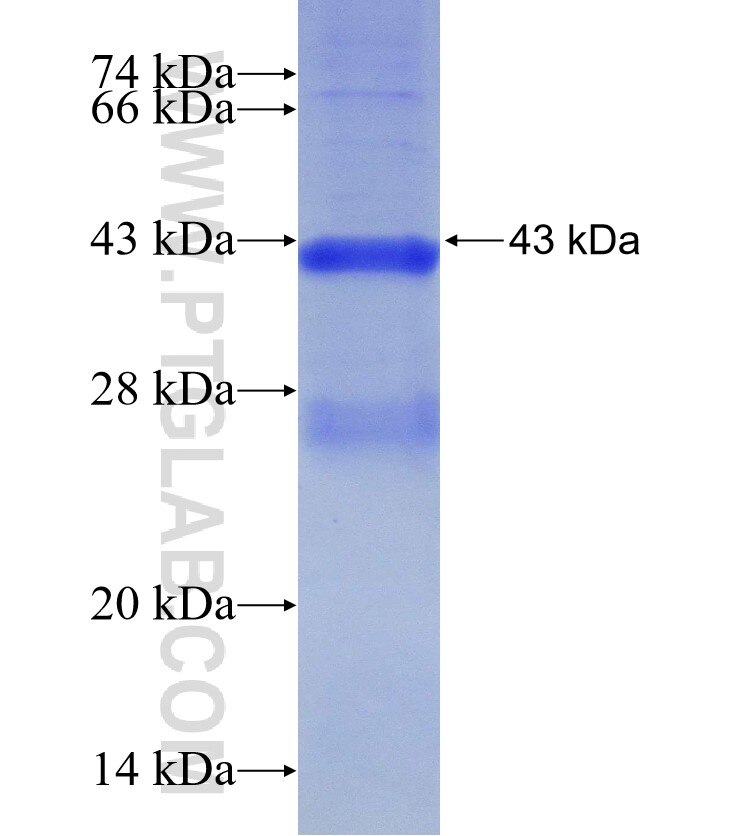 PPP2R2B fusion protein Ag30757 SDS-PAGE