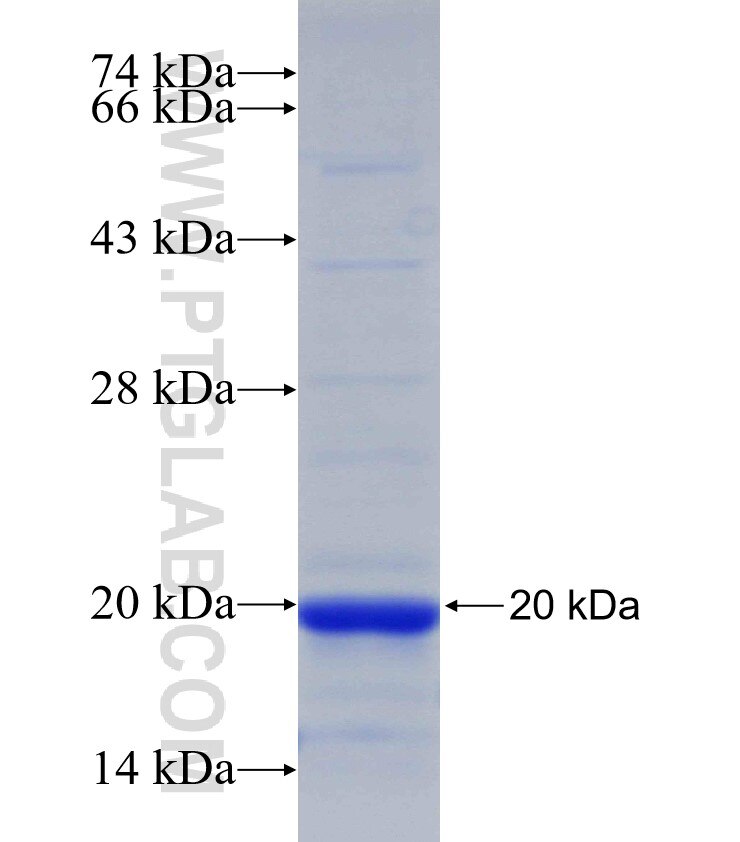 PPP2R2B fusion protein Ag30774 SDS-PAGE
