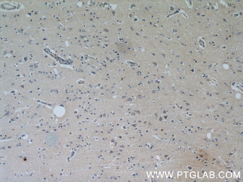 Immunohistochemistry (IHC) staining of human brain tissue using PPP2R2C Polyclonal antibody (12747-1-AP)