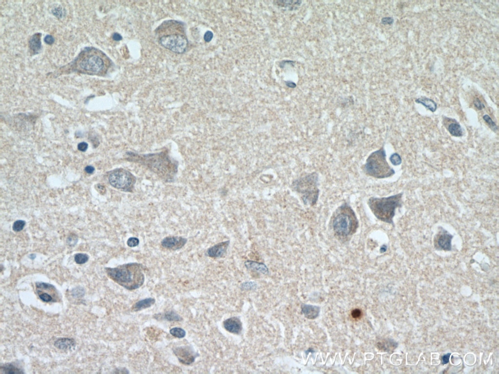 Immunohistochemistry (IHC) staining of human brain tissue using PPP2R2C Polyclonal antibody (12747-1-AP)