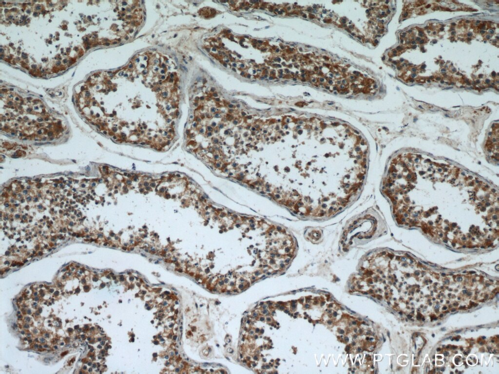 Immunohistochemistry (IHC) staining of human testis tissue using PPP2R2C Polyclonal antibody (12747-1-AP)